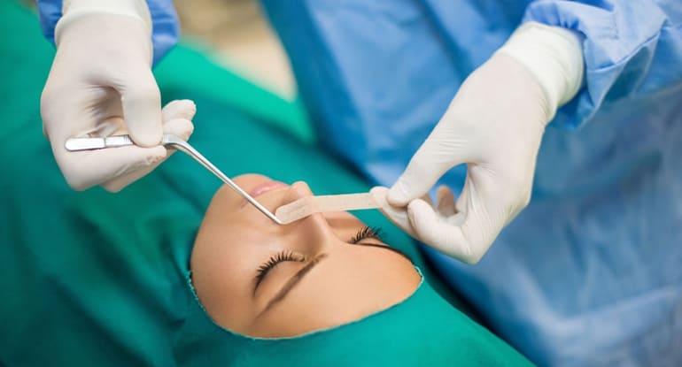 Cirugia de Tabique nasal