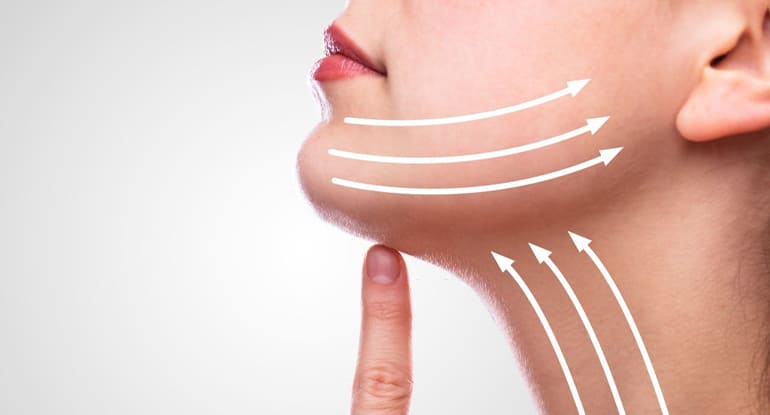 Liposucción de Cuello